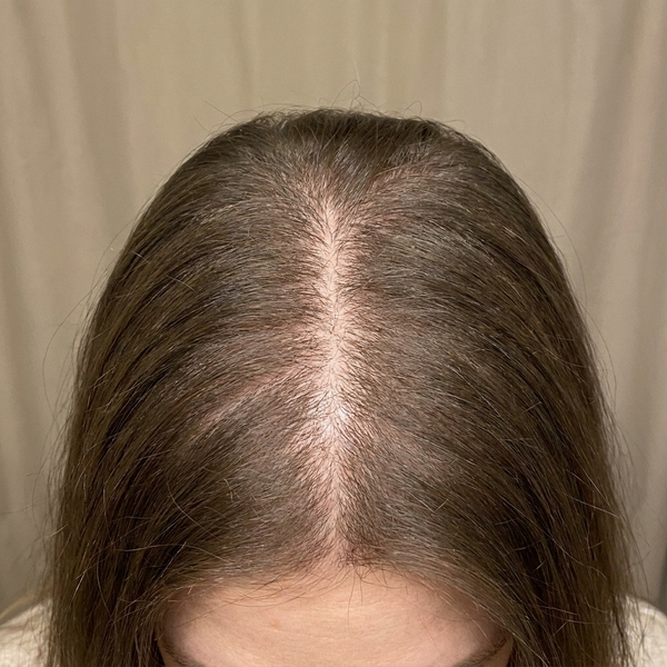 Before using ANOINT Hair Brush