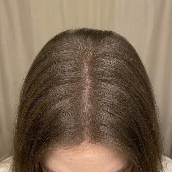 After using ANOINT Hair Brush
